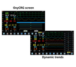 Analizador anestésico portátil TFT 15,6” LCD del oxígeno del equipo de supervisión
